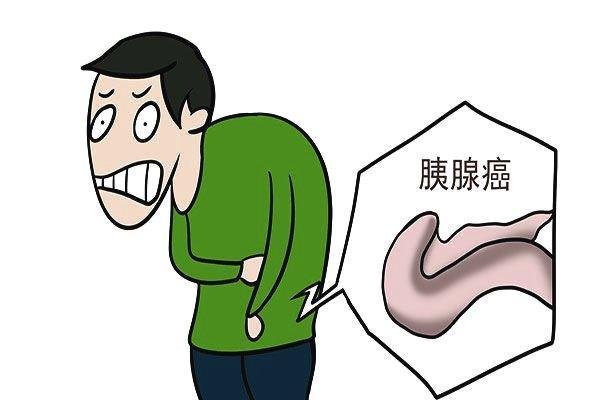 杭州肿瘤老中医：女子胃疼久治不愈 经检查患上胰腺癌