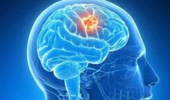 脑瘤对患者的危害有哪些?