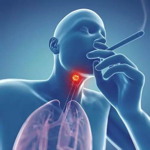 ：吞咽法测试食道癌不靠谱？你还有哪些食道癌误区