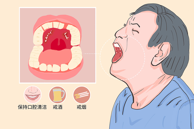 御和堂老中医说：任何疾病都会导致口腔癌！