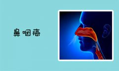 男性鼻咽癌的早期症状有哪些?